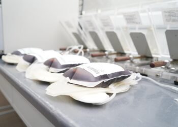 Innovación médica mejora seguridad en trasplantes en México