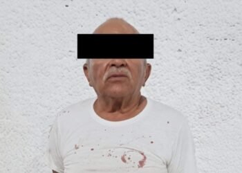 ¿Se equivocó de víctima? Detienen a abuelito tras brutal ataque en Granjas