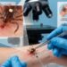 ¿Qué es el virus Bourbon? Confirman su presencia por primera vez en Nueva York
